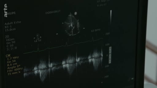 Un écran médical affiche une échographie cardiaque en mode Doppler, montrant des mesures de flux sanguin et le rythme cardiaque d'un patient lors d'un examen médical.