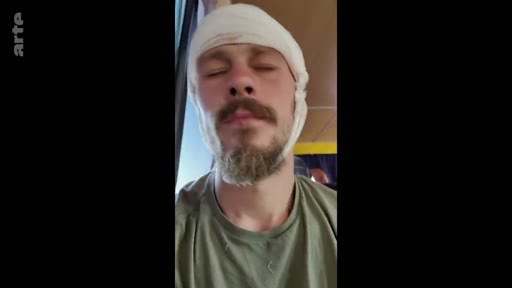 Un soldat blessé, portant un bandage autour de la tête, est filmé en gros plan dans ce qui semble être un environnement hospitalier ou de transport médicalisé. L'image illustre les conséquences physiques des combats et le processus de récupération des militaires blessés.
