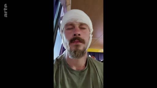 Un soldat blessé, portant un bandage autour de la tête, témoigne de son expérience lors d'une interview filmée. Il porte un t-shirt vert et semble être dans un environnement intérieur, possiblement un hôpital ou un centre de convalescence.