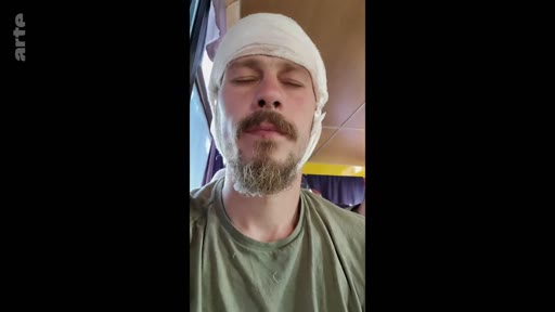 Un soldat blessé, portant un bandage autour de la tête, est filmé en gros plan dans ce qui semble être un environnement de convalescence ou de transport médicalisé. L'image illustre la réalité des blessures de guerre et le processus de récupération des militaires.