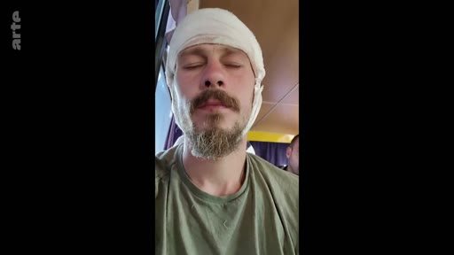Un soldat blessé, portant un bandage autour de la tête, est filmé en gros plan alors qu'il se repose, probablement lors d'un transfert ou d'une convalescence.