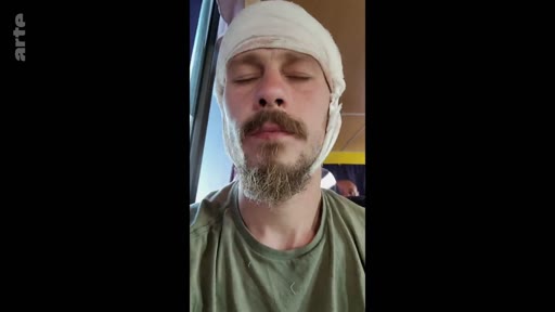 Un soldat blessé, portant un bandage autour de la tête, est filmé en gros plan dans ce qui semble être un véhicule ou un hôpital militaire. L'homme, barbu et vêtu d'un t-shirt vert, a les yeux fermés, illustrant les conséquences physiques des conflits armés.
