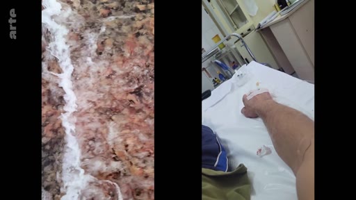 Un écran divisé illustrant le contraste entre la nature, représentée par des vagues déferlantes, et le milieu hospitalier, avec un patient recevant un traitement par perfusion intraveineuse.