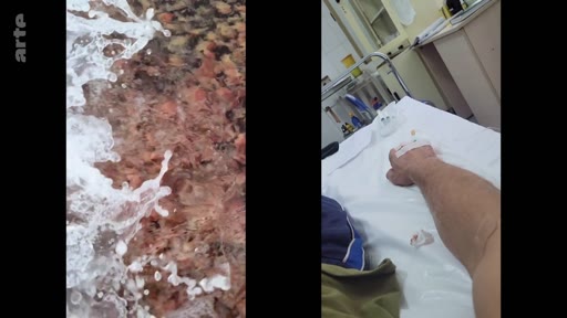 Une image en écran divisé illustrant le contraste entre la nature, avec des vagues déferlant sur des galets, et le milieu hospitalier, où l'on voit le bras d'un patient sous perfusion sur un lit d'hôpital.