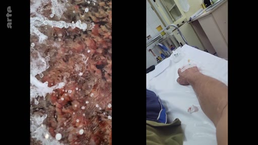 Un écran divisé illustrant le contraste entre la nature, avec de l'eau en mouvement, et le milieu hospitalier, où un patient est allongé sur un lit d'hôpital avec une perfusion au bras.