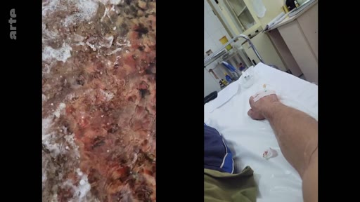 Un montage vidéo en écran divisé illustrant le contraste entre la nature, avec des vagues se brisant sur des rochers, et le milieu hospitalier, où l'on voit le bras d'un patient avec une perfusion intraveineuse.
