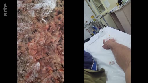 Un écran divisé montre à gauche un gros plan sur de l'eau vive et à droite un patient allongé dans un lit d'hôpital avec une perfusion au bras, illustrant le contraste entre la nature et le milieu médical.