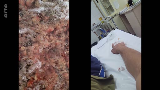 Image divisée montrant à gauche des décombres et à droite le bras d'un patient sous perfusion dans un hôpital, illustrant les conséquences d'un conflit ou d'une catastrophe.